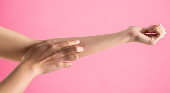 Digigit Kelabang Ini Penanganan yang Bisa Dilakukan